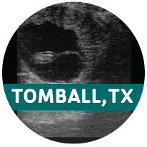 Ultrasound_round image-01