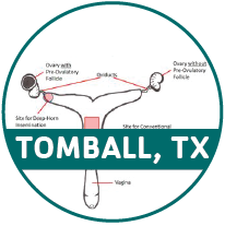 dhi_TB_round image-01